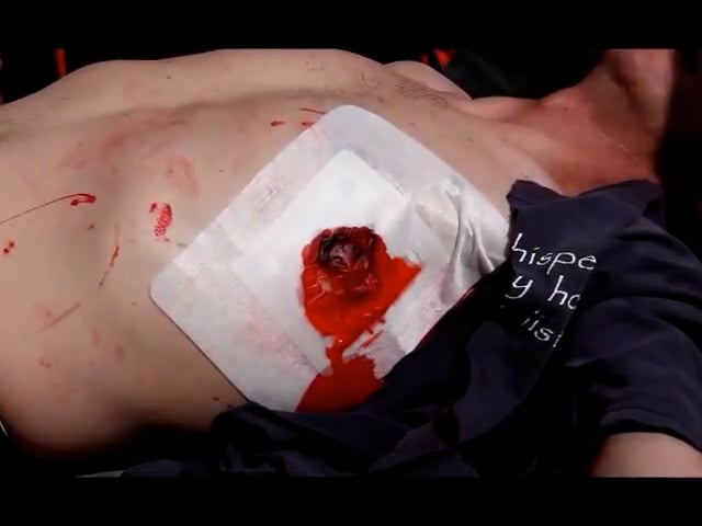 Russell Chest Seal Simulation